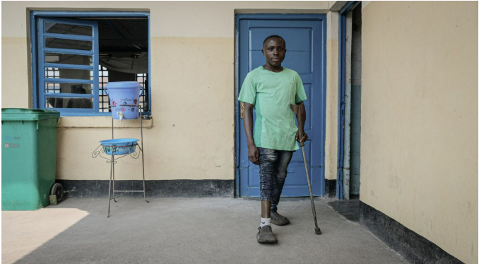 Espoir, a prosthesis user from Kitshanga, Democratic Republic of the Congo, is one of many AT users who benefit from the Assistive Products List developed by the ATscale-supported programme. Photo Credit: E. N’Sapu / HI