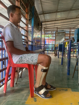 A man seen in profile sitting on a red plastic chair, wearing a supportive orthotic brace on his lower left leg.